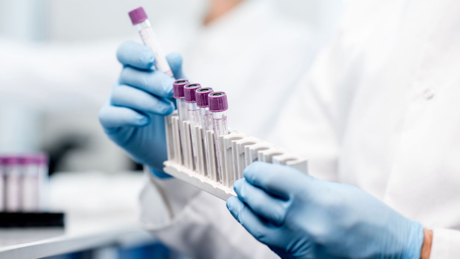 От известното досега вирусът може да причини умерени грипоподобни симптоми