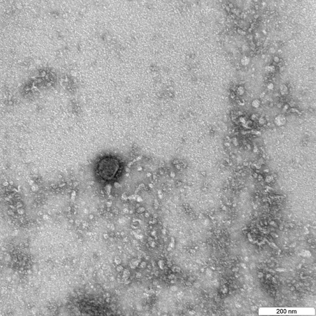 Снимка на коронавирус COVID-19, публикувана от Федералната служба по надзор в областта на защитата на правата на потребителите (Роспотребнадзор)