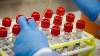 914 са новодиагностицираните с коронавирусна инфекция пациенти през последното денонощие