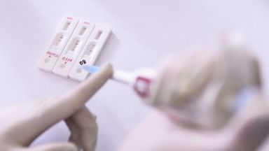 Здравната каса ще плаща тестовете за коронавирус, но по преценка