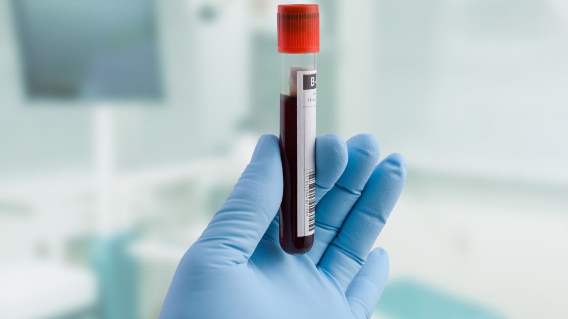 Лабораторията в УМБАЛ "Свети Георги" ще е само за пациенти с коронавирус
