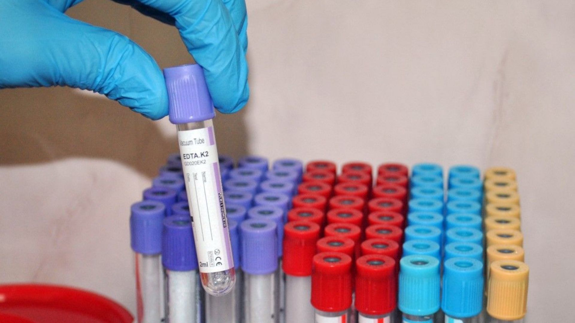 Жена която е болна от COVID 19 се свързва с NOVA