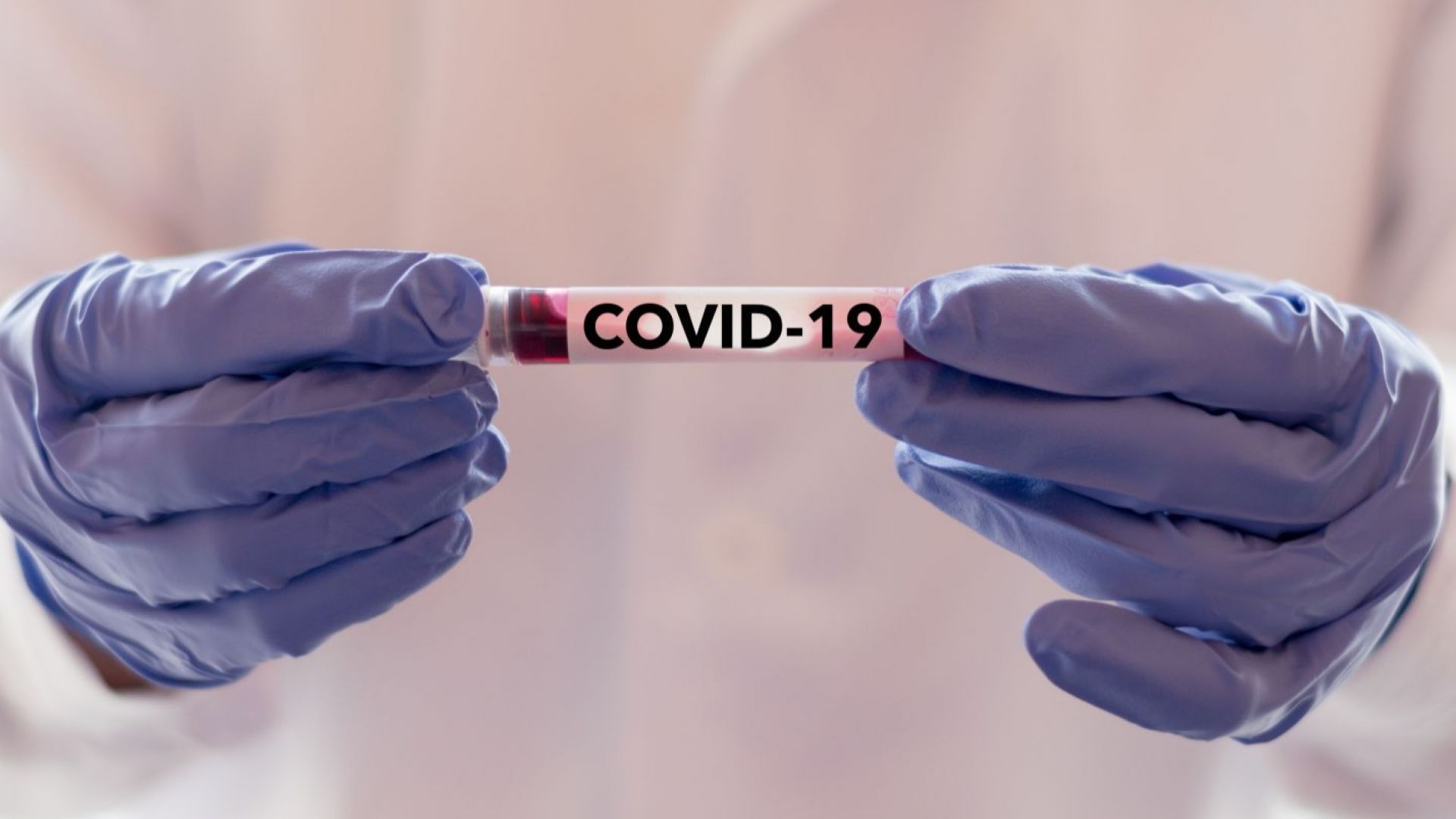 Лекар от Ямбол е повторно заразен с COVID-19
