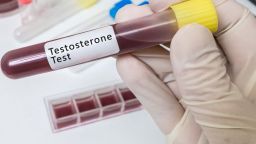  Блокирането на тестостерона може да защити мъжете от коронавируса