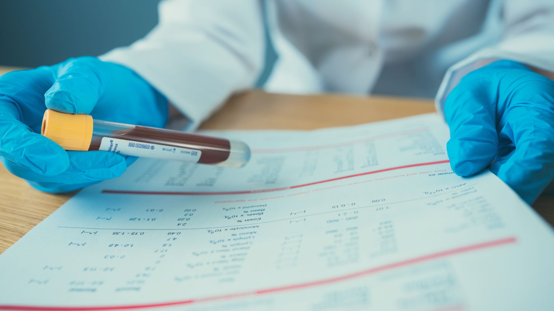 Броят на жертвите на СПИН в Украйна от началото на