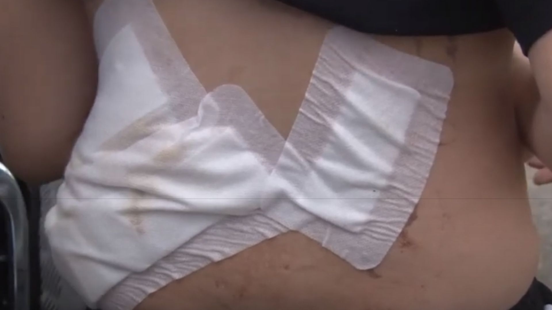 Виж още 50 килограмово куче нахапа жестоко 10 годишно дете в Крън