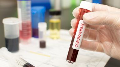 151 са новите случаи с коронавирус у нас при направени