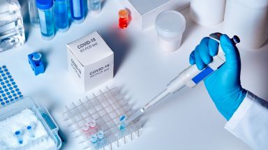 142 са новодиагностицираните с Covid 19 лица през последното денонощие PCR