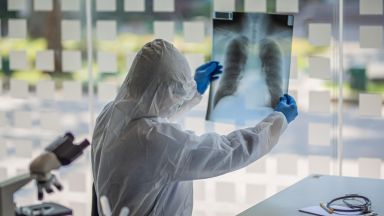 155 са новодиагностицираните с коронавирусна инфекция лица през изминалите 24