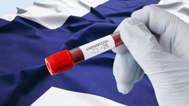 169 с 34 повече от вчера са новодиагностицираните с коронавирусна