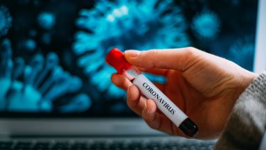 157 са новите случаи на коронавирус и почти два пъти