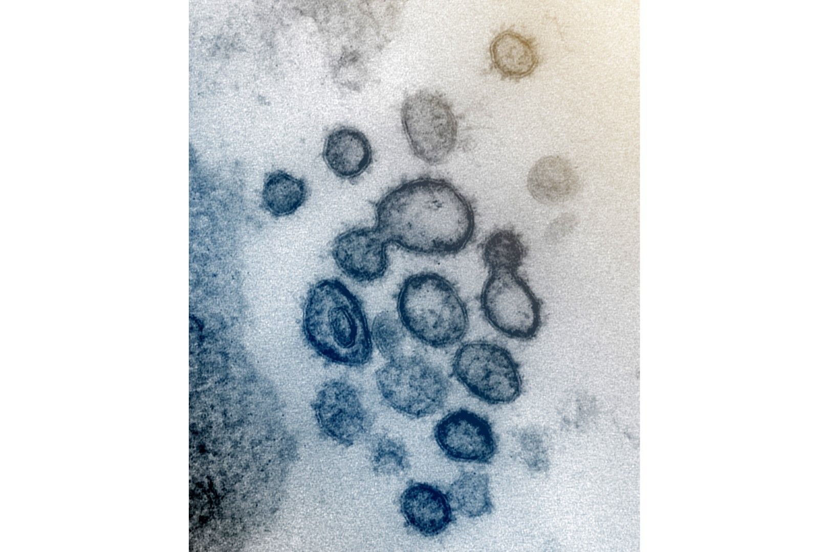 Недатирано изображение от електронен микроскоп, предоставено от американския Национален институти по здравеопазване през февруари 2020 г., показва новия коронавирус SARS-CoV-2. Известен също като 2019-nCoV, вирусът причинява COVID-19