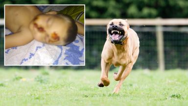 6 годишно момченце е било нападнато и жестоко нахапано по лицето