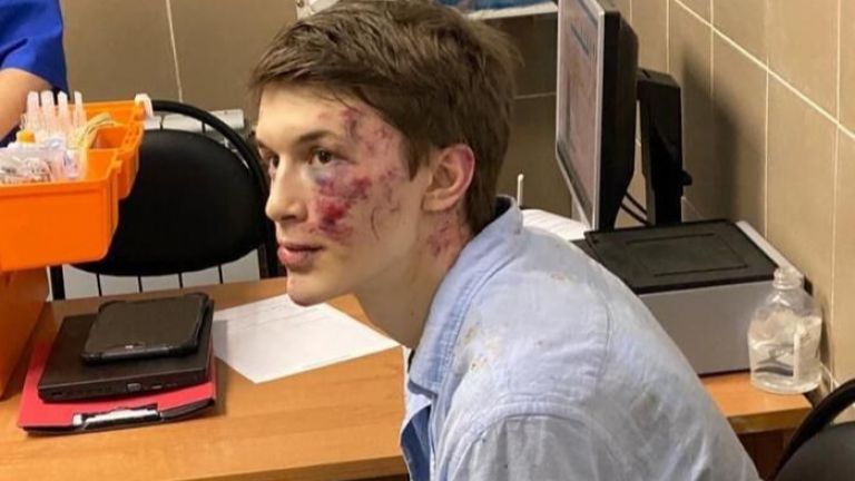 Журналист и активист, отнасящ се критично към Кремъл, беше ранен