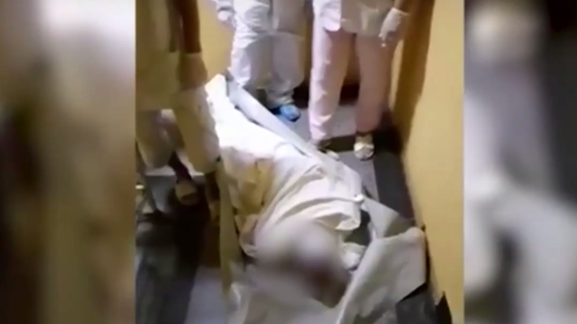 В Ямболската болница пренасят пациенти по стълбите с мушами