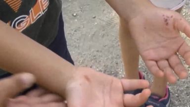 10 годишното момченце което влезе в болница след токов удар от