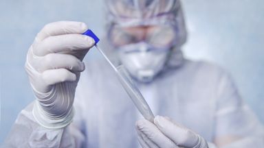 83 са новите случаи на COVID 19 у нас направени са