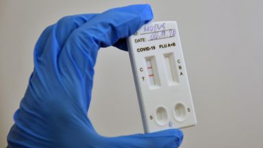 Новите случаи на коронавирус към полунощ са 233 с 319