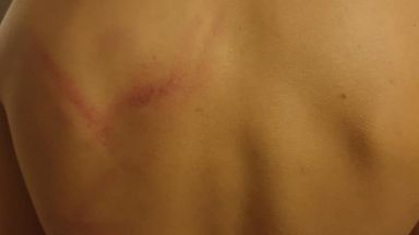 Софиянец съобщи във Фейсбук че двама маскирани младежи са пребили