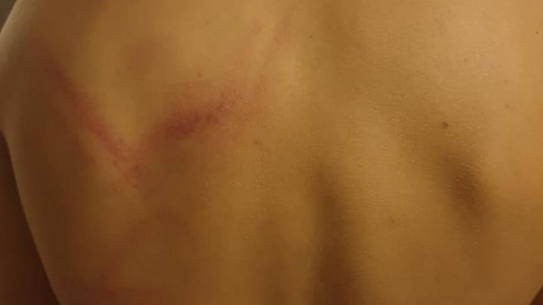 Софиянец съобщи във Фейсбук, че двама маскирани младежи са пребили