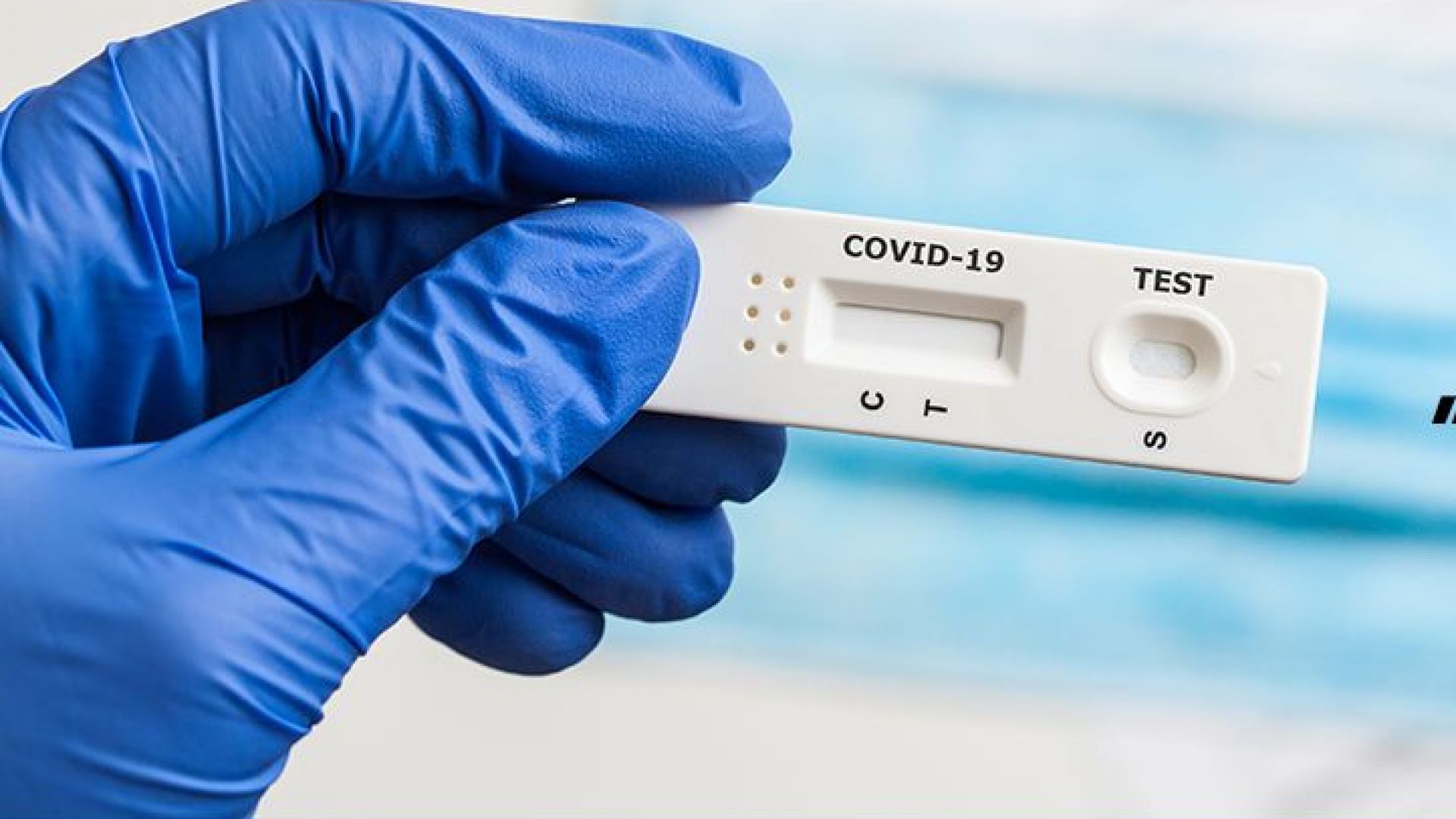 МЗ пуска голям брой безплатни антигенни тестове за Covid-19