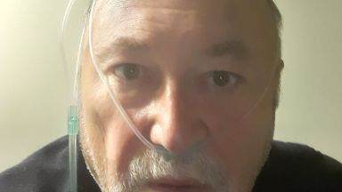 Политикът Александър Йорданов е прекарал изключително тежко новия коронавирус За