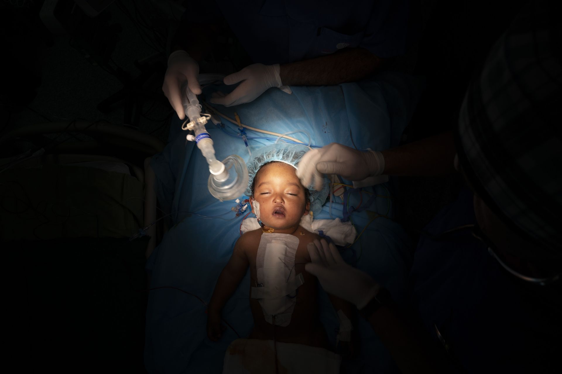 Махат кислородната маста на едногодишния Язан след сърдечна операция в Националния център за сърце в Триполи, Либия. (27 февруари 2020 г.) Пътуванета на Язан от малкия му пустинен роден град завърши с петчасова операция. Той е едно от 1000 деца, лекувани от групата на д-р Уилям Новик, откакто тя дойде за първи път в Либия след 2011 година.