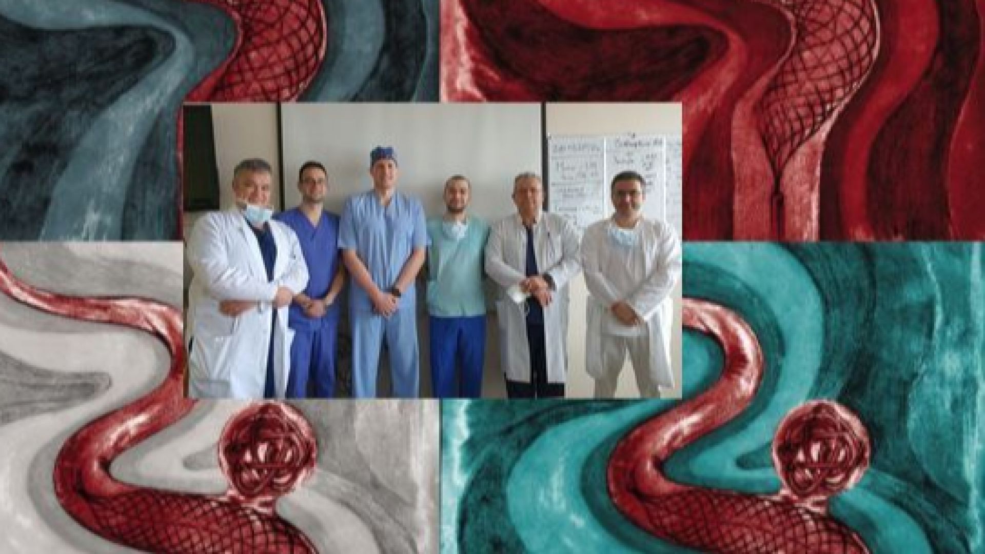 Български медици са първи в света с ново лечение на тежки мозъчни аневризми
