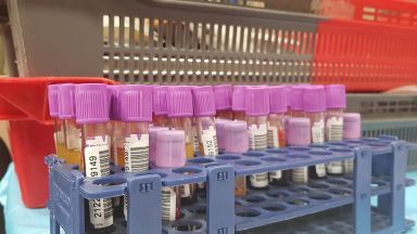 Новите случаи на коронавирусна инфекция у нас са 1442 при