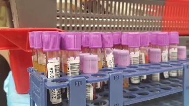 4626 нови случаи на коронавирусна инфекция бяха регистрирани в страната