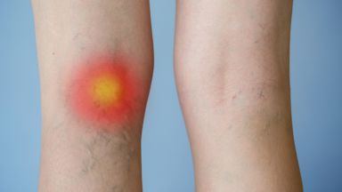 Друг рисков фактор е свързан с количеството време което прекарваме