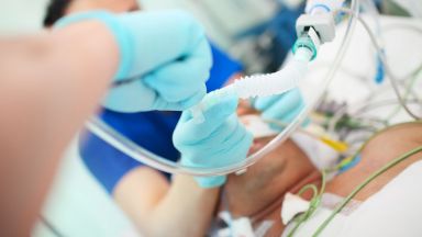 След 92 дни интубация лекари върнаха към живота 50 годишен мъж