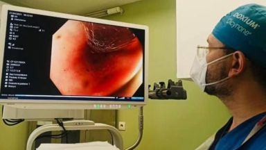 Хибридната хирургия на Пирогов спаси 33 годишен погълнал дървено яйце съобщиха