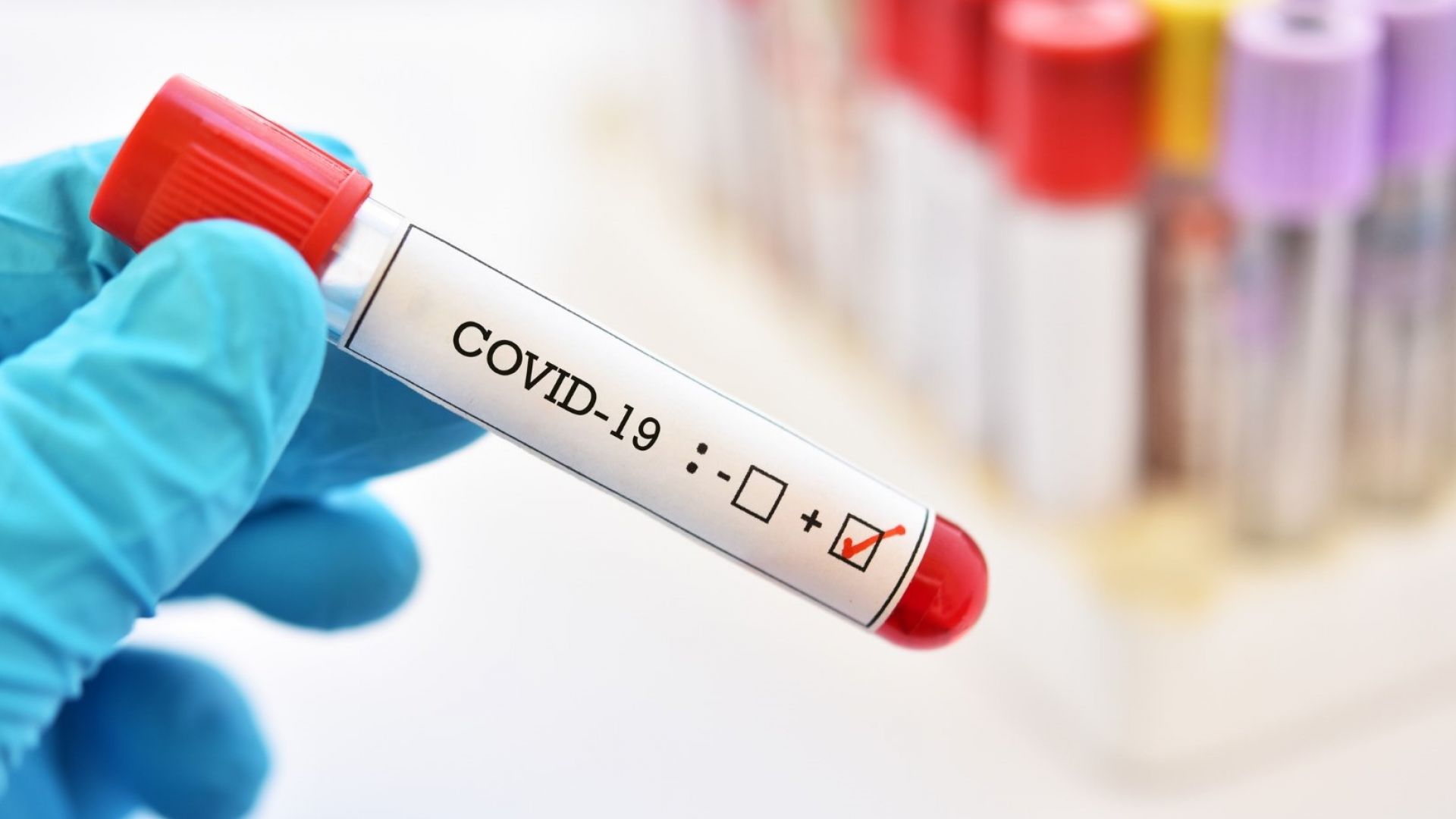 Новозаразените с COVID-19 остават под 1%, починалите са 7 за денонощието