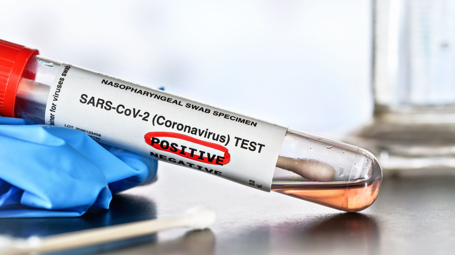 Втори случай на Делта вариант на коронавируса във Варна