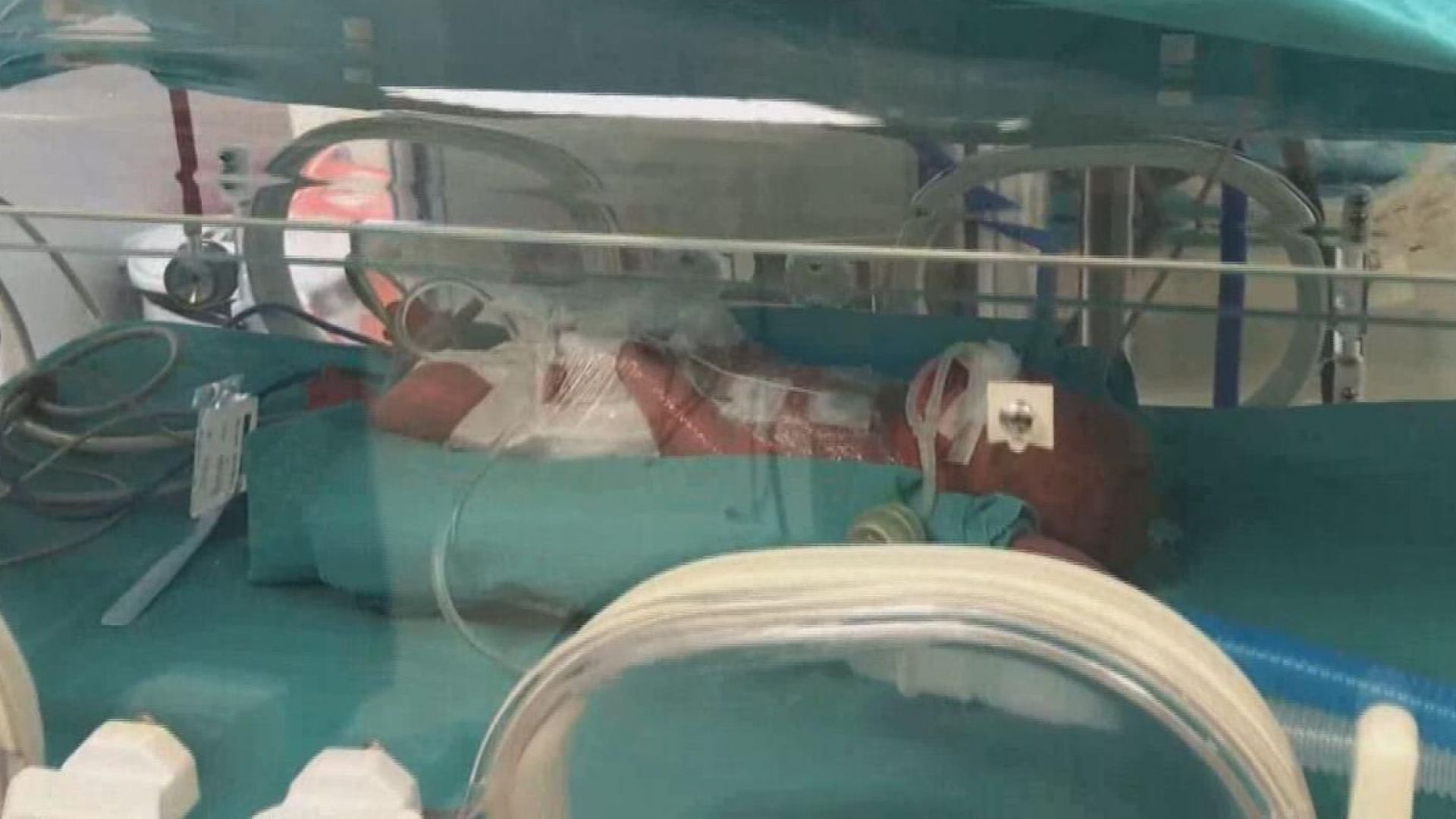 След 5 години чакане: Жена роди петзнаци в Измит (снимки/видео)