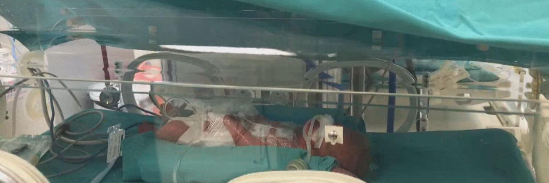 След 5 години чакане: Жена роди петзнаци в Измит (снимки/видео)