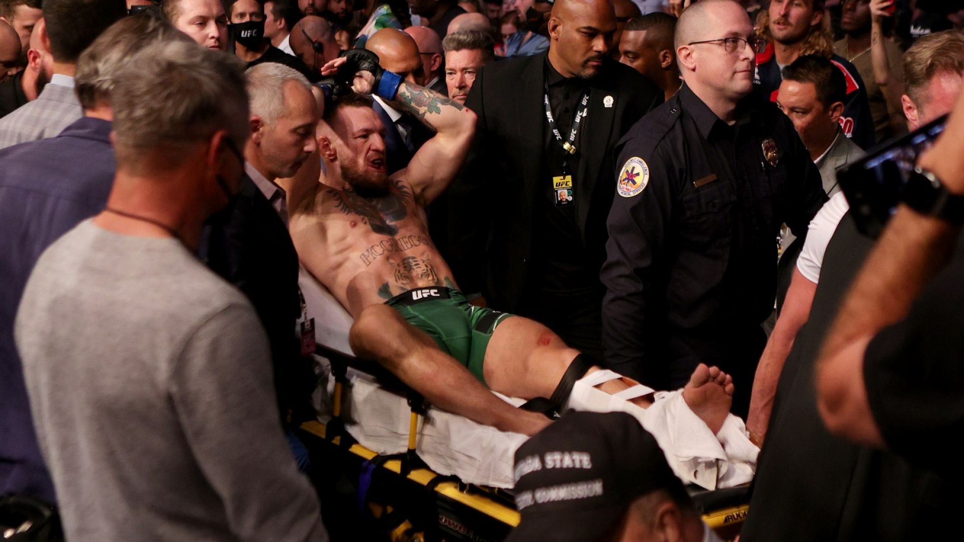 Брутална контузия и нова загуба за Конър Макгрегър в клетката на UFC