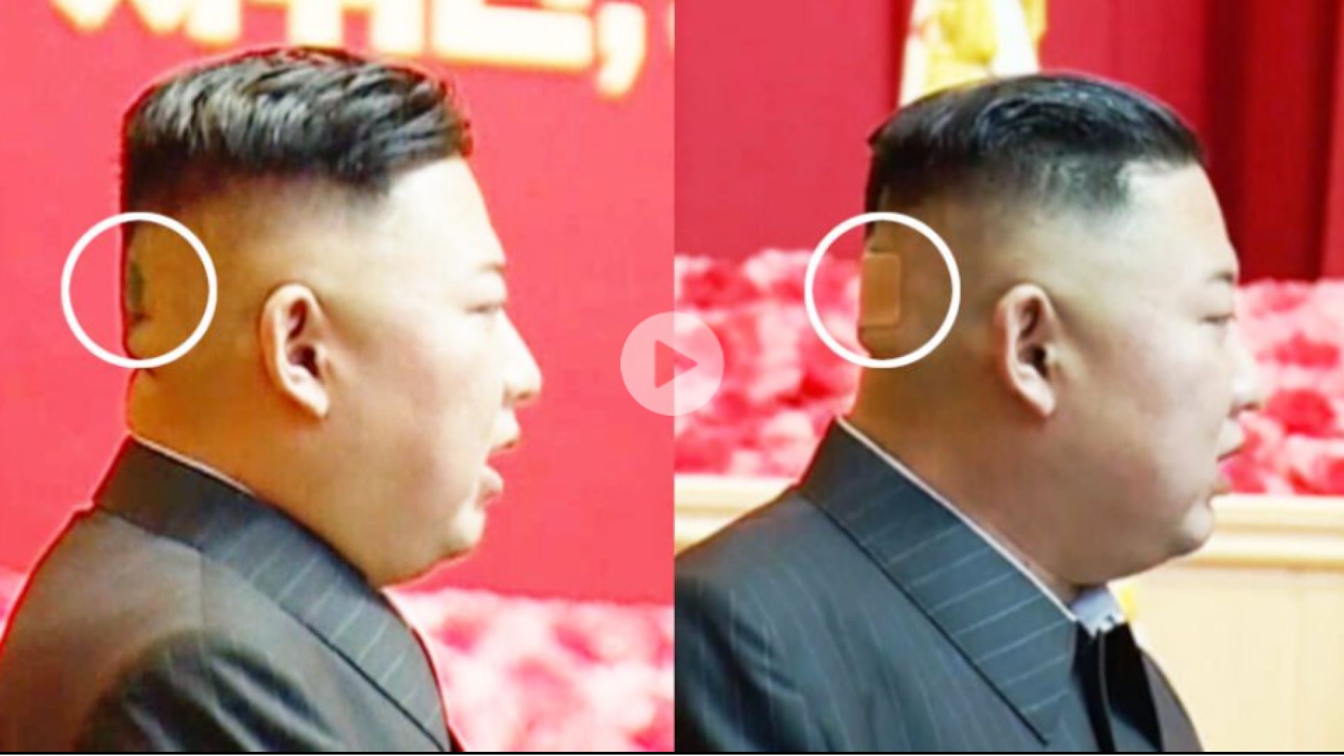 Ким Чен-ун се появи с мистериозно тъмно петно и лепенка на тила