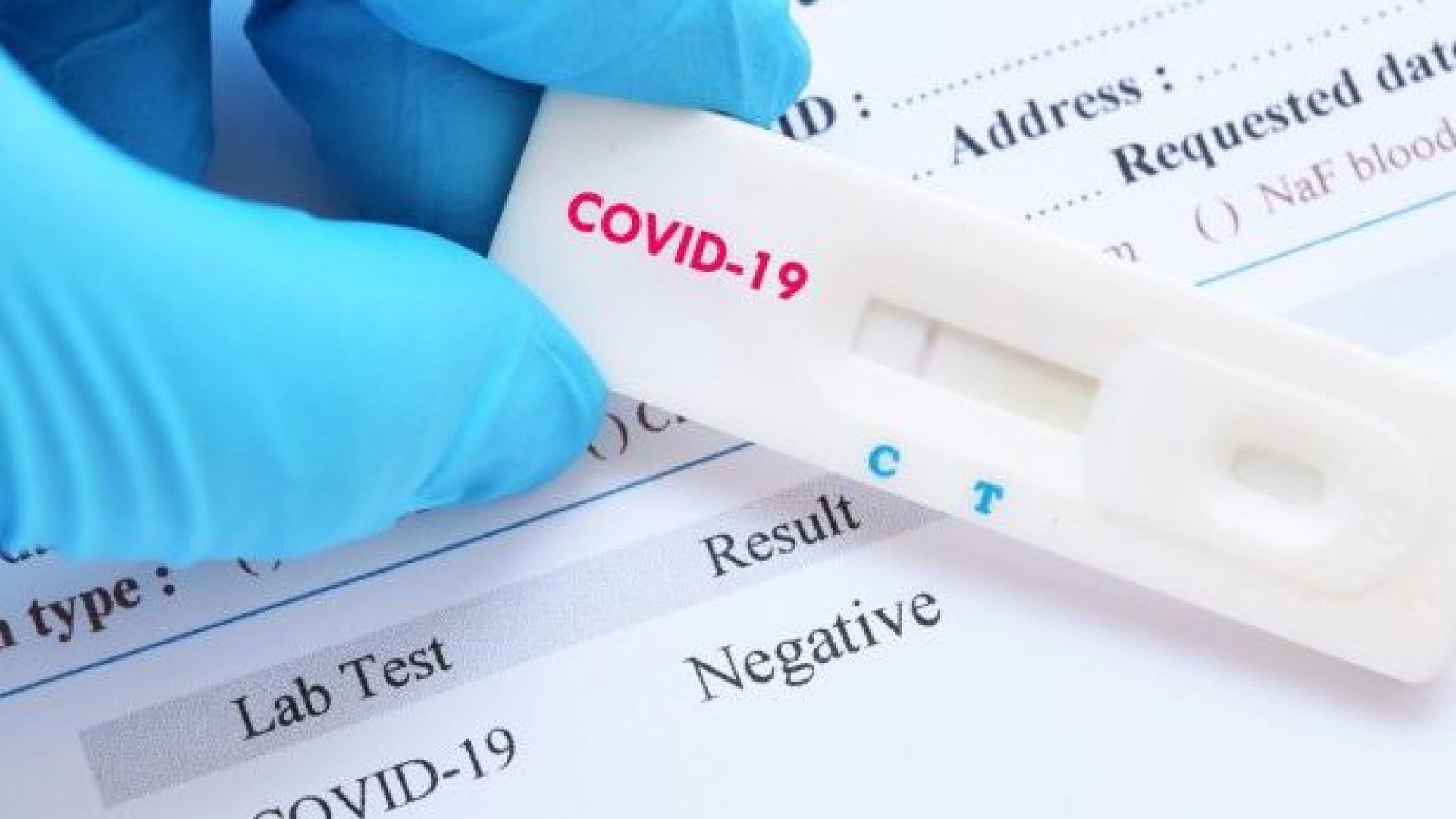 Скок на случаите на COVID -  9,5%  от тестваните, дете на 9 г. почина
