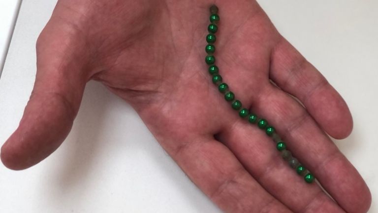 6-годишната Мария от Бургас е оперирана по спешност в Пирогов