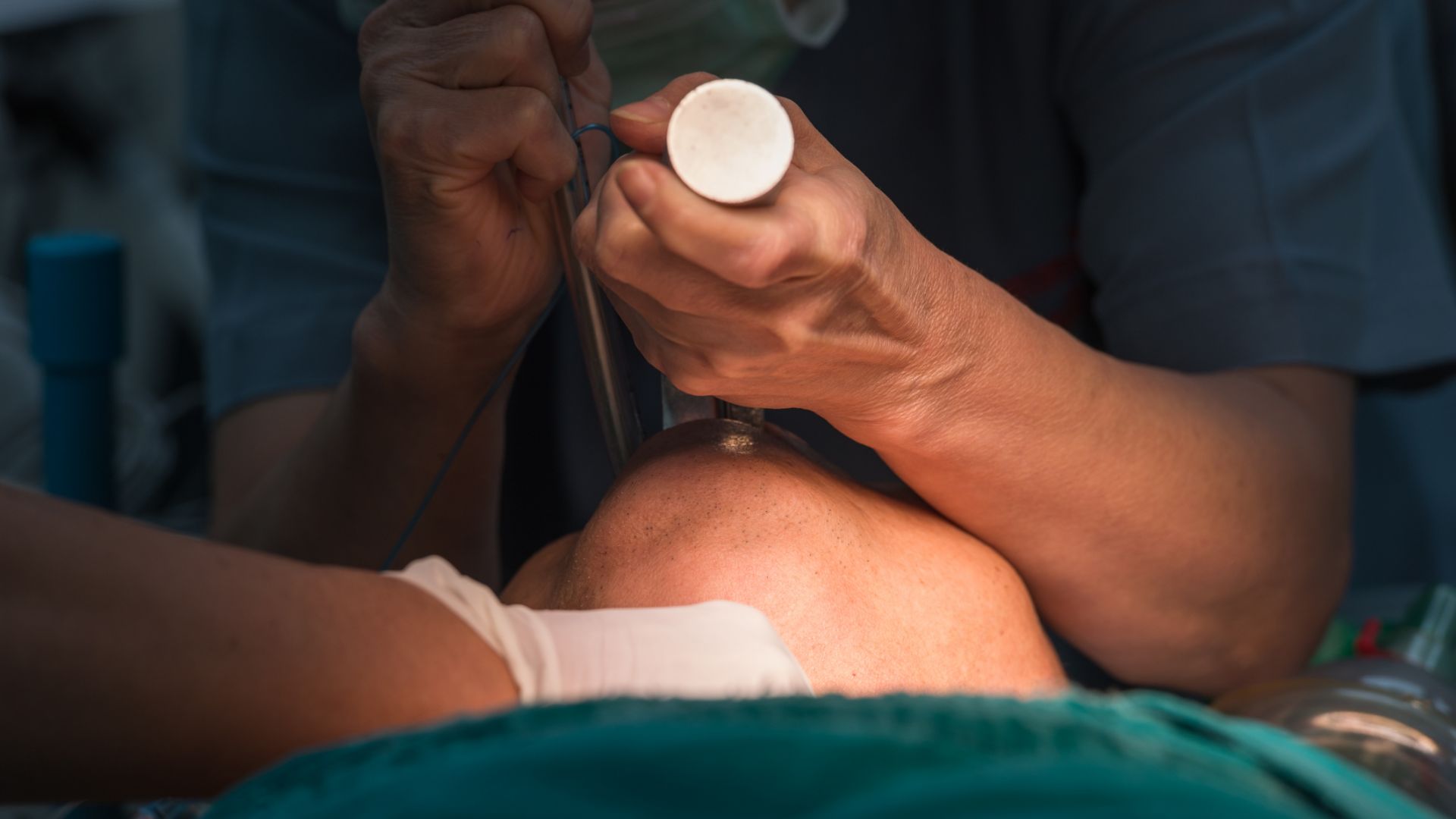 Смъртта на родилката Евгения: Анестезиолог объркал трахеята с хранопровода