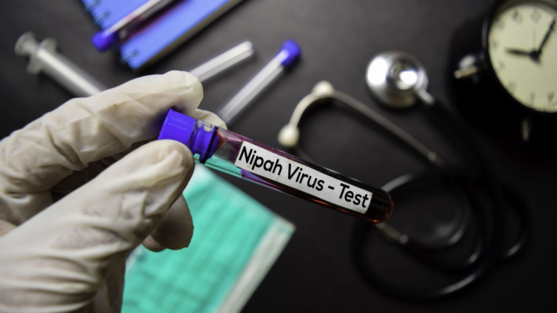 Един от най-смъртоносните: какво се знае за вируса Нипа