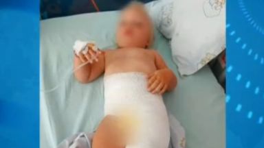 Дете е със сериозни изгаряния след посещение на столична ясла