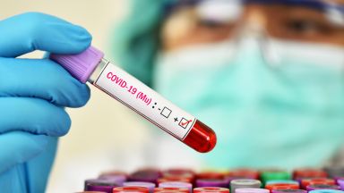 Повод за оптимизъм няма пета вълна предстои За мен