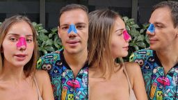Време за промяна: Алекс и Даниел Петканови си направиха ринопластика заедно