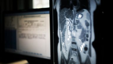 Поликлиники не искат 47 преносими рентгена и ехографа за 10 млн. лв., защото не могат да ги ползват