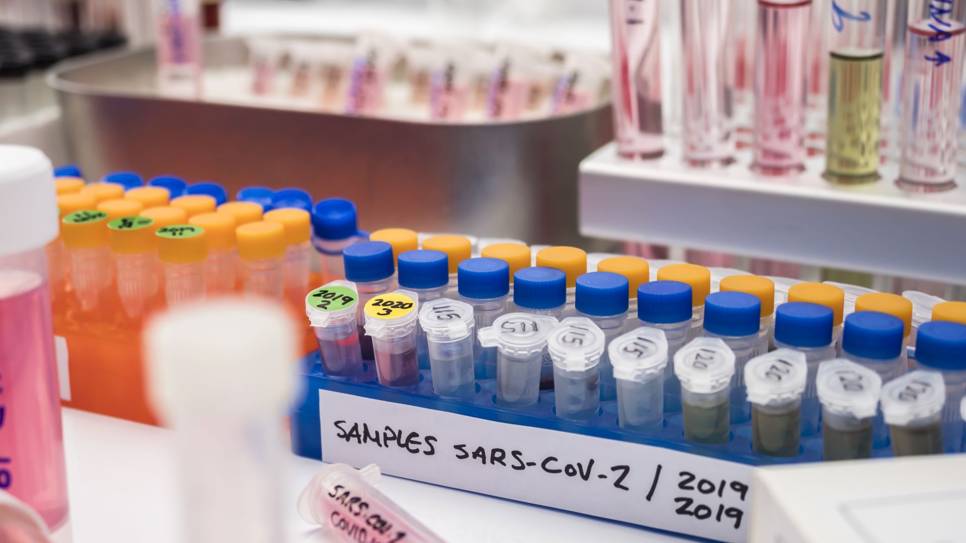 Здравната каса ще заплаща тестовете за антитела срещу COVID-19