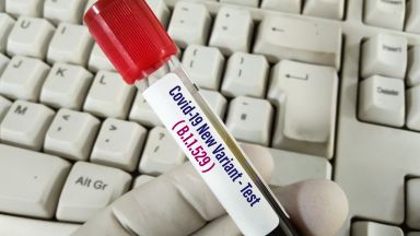 През денонощието са направени 578 теста от които положителни са