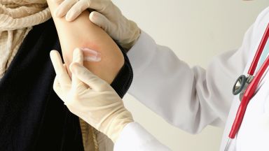 Специалисти от Клиниката по дерматология на Военномедицинската академия ВМА ще